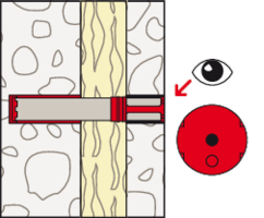 Wetterschalen-Saniersystem FWS II | fischer